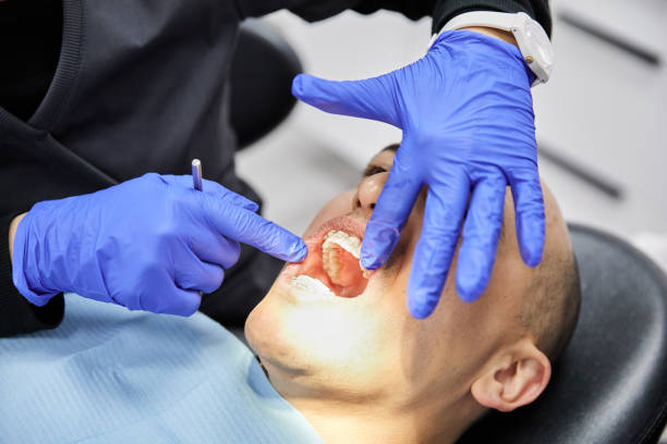 Best Chipped Tooth Repair Near Me  in Mosinee, WI